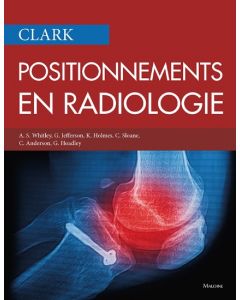 Clark : Positionnements en radiologie